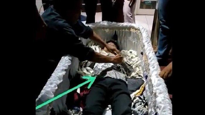 Inilah Penampakan Us Pria Yang Disebut Mayat Hidup